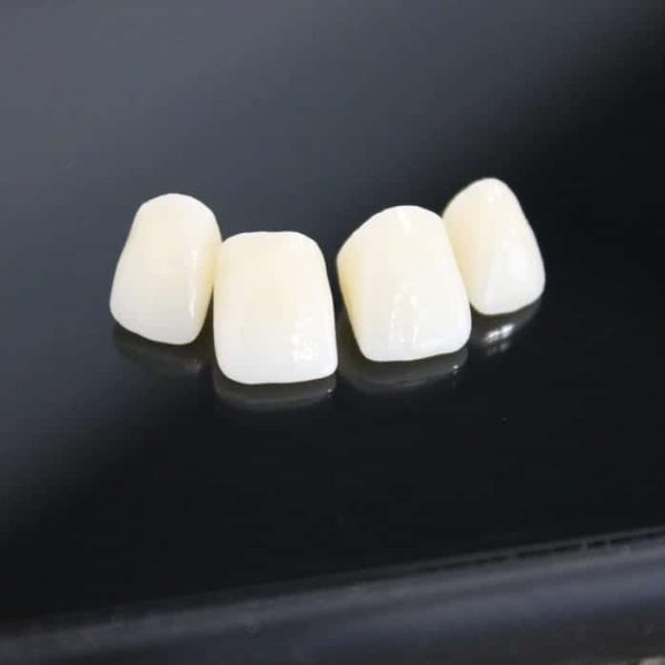 Dental Veneers Mackay