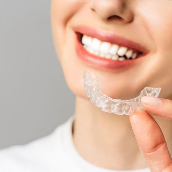 Invisalign Mackay