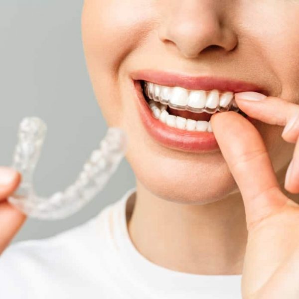 Mackay Invisalign