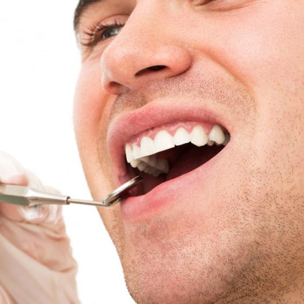 Painless Tooth Extraction Mackay